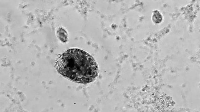 Mikroscopul E. gigatrox: Transformarea Hulk a unui microorganism